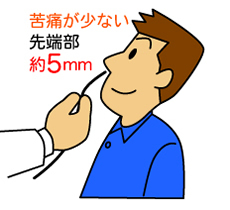 経鼻内視鏡の特徴