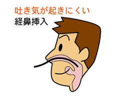 経鼻内視鏡の特徴